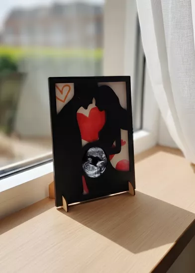 Romantik Sevgililer Ultrason Çerçevesi | Kişiye Özel